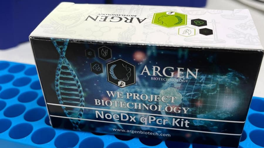 HBV, HCV ve HIV Multiplex RT PCR Kitleri