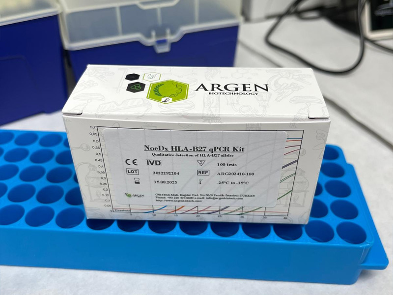 NoeDx HLA-B27 qPcr Kit