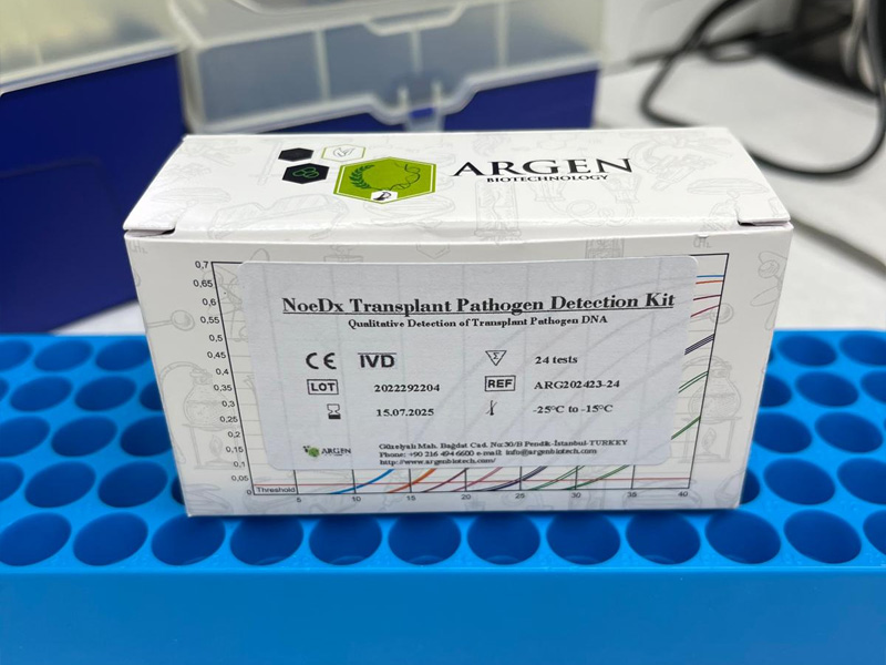 NoeDx Transplant qPcr Kit